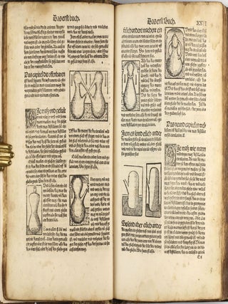 Das buch zu distillieren die zusamen gethonen ding Composita genant durch die einzige(n) ding und das buch Thesaurus pauperu(m) für die armen durch experiment ... zu trost un(d) heil de(r) menschen un(d) nutzlich ir leben und leib daruß zu erlengeren und in gesuntheit zu behalten.