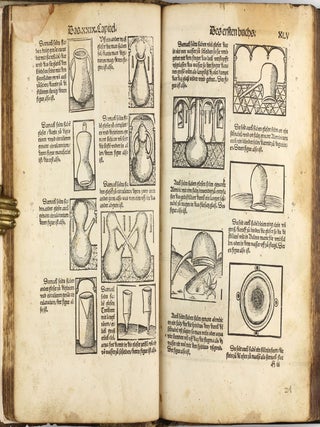 Das buch zu distillieren die zusamen gethonen ding Composita genant durch die einzige(n) ding und das buch Thesaurus pauperu(m) für die armen durch experiment ... zu trost un(d) heil de(r) menschen un(d) nutzlich ir leben und leib daruß zu erlengeren und in gesuntheit zu behalten.