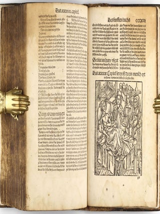 Das buch zu distillieren die zusamen gethonen ding Composita genant durch die einzige(n) ding und das buch Thesaurus pauperu(m) für die armen durch experiment ... zu trost un(d) heil de(r) menschen un(d) nutzlich ir leben und leib daruß zu erlengeren und in gesuntheit zu behalten.