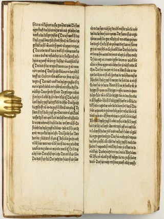Das Buch der Natur / Regimen sanitatis - Das ist von der ordenung der gesuntheyt.