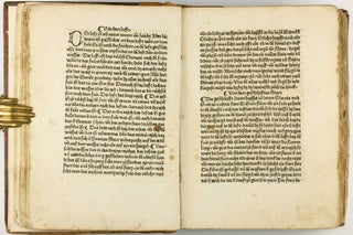 Das Buch der Natur / Regimen sanitatis - Das ist von der ordenung der gesuntheyt.