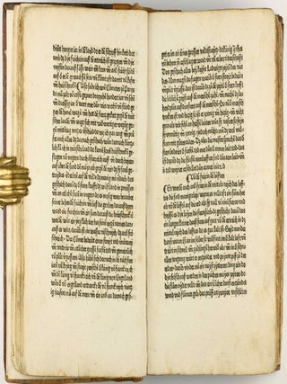 Das Buch der Natur / Regimen sanitatis - Das ist von der ordenung der gesuntheyt.