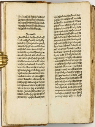 Das Buch der Natur / Regimen sanitatis - Das ist von der ordenung der gesuntheyt.