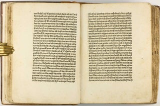 Das Buch der Natur / Regimen sanitatis - Das ist von der ordenung der gesuntheyt.