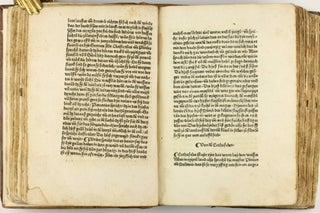 Das Buch der Natur / Regimen sanitatis - Das ist von der ordenung der gesuntheyt.
