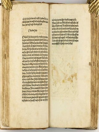 Das Buch der Natur / Regimen sanitatis - Das ist von der ordenung der gesuntheyt.