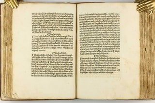 Das Buch der Natur / Regimen sanitatis - Das ist von der ordenung der gesuntheyt.