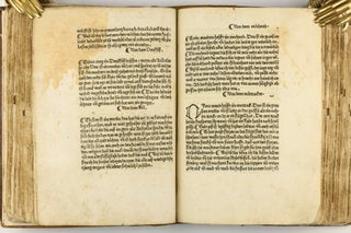 Das Buch der Natur / Regimen sanitatis - Das ist von der ordenung der gesuntheyt.