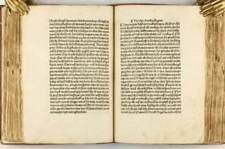 Das Buch der Natur / Regimen sanitatis - Das ist von der ordenung der gesuntheyt.