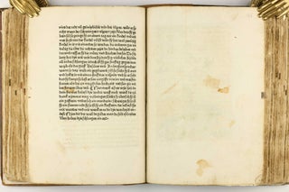 Das Buch der Natur / Regimen sanitatis - Das ist von der ordenung der gesuntheyt.