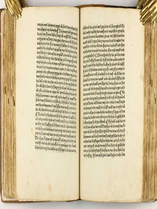 Das Buch der Natur / Regimen sanitatis - Das ist von der ordenung der gesuntheyt.