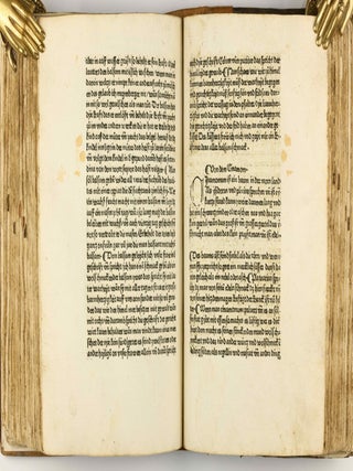 Das Buch der Natur / Regimen sanitatis - Das ist von der ordenung der gesuntheyt.