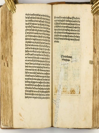 Das Buch der Natur / Regimen sanitatis - Das ist von der ordenung der gesuntheyt.