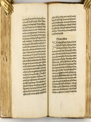 Das Buch der Natur / Regimen sanitatis - Das ist von der ordenung der gesuntheyt.