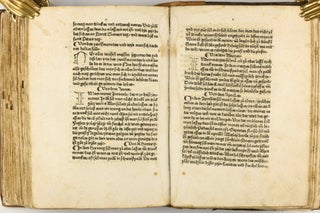 Das Buch der Natur / Regimen sanitatis - Das ist von der ordenung der gesuntheyt.