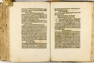 Das Buch der Natur / Regimen sanitatis - Das ist von der ordenung der gesuntheyt.