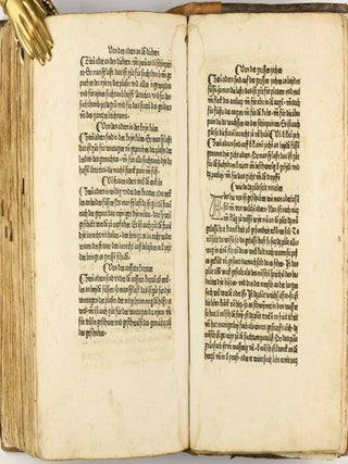 Das Buch der Natur / Regimen sanitatis - Das ist von der ordenung der gesuntheyt.