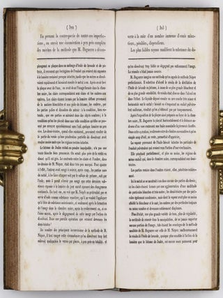 Le daguerréotype. In: Annales de Chimie et de Physique, vol. 71, 1839, pp. 313-340.