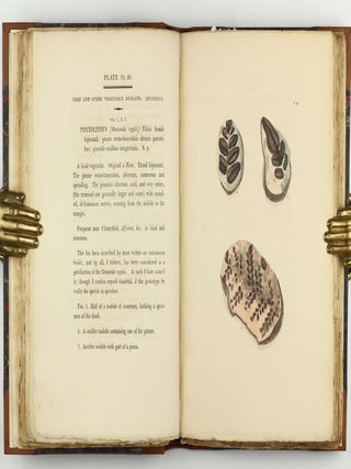 Petrificata Derbiensia; or, Figures and Descriptions of Petrifactions Collected in Derbyshire. Volume I (all published).