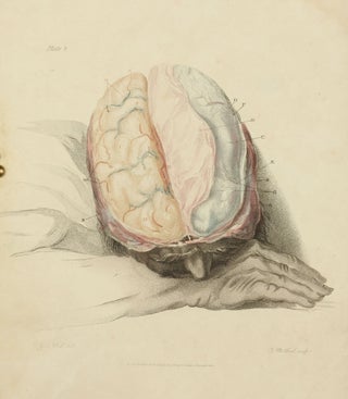 The Anatomy of the Brain, Explained in a Series of Engravings.