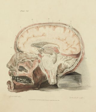 The Anatomy of the Brain, Explained in a Series of Engravings.