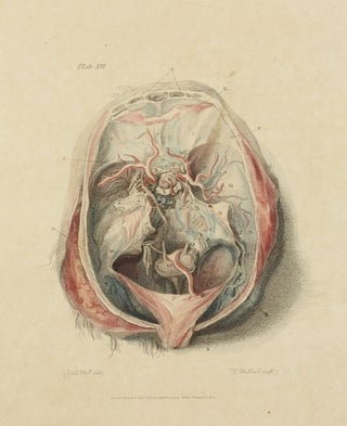 The Anatomy of the Brain, Explained in a Series of Engravings.