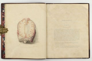 The Anatomy of the Brain, Explained in a Series of Engravings.