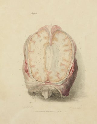 The Anatomy of the Brain, Explained in a Series of Engravings.