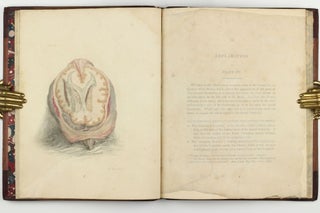 The Anatomy of the Brain, Explained in a Series of Engravings.