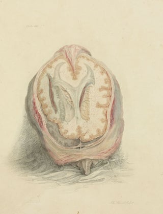 The Anatomy of the Brain, Explained in a Series of Engravings.