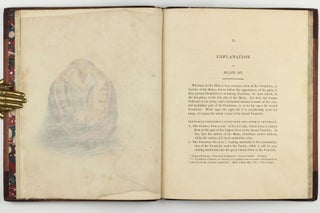 The Anatomy of the Brain, Explained in a Series of Engravings.