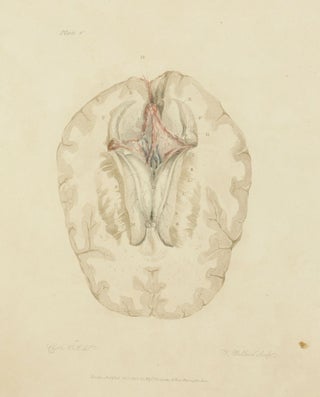 The Anatomy of the Brain, Explained in a Series of Engravings.