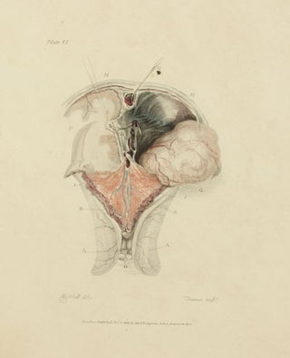 The Anatomy of the Brain, Explained in a Series of Engravings.