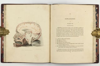 The Anatomy of the Brain, Explained in a Series of Engravings.
