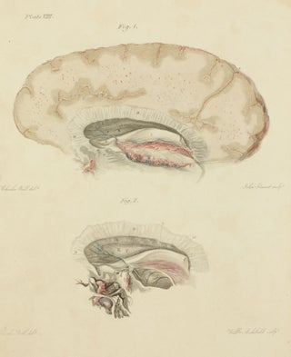 The Anatomy of the Brain, Explained in a Series of Engravings.