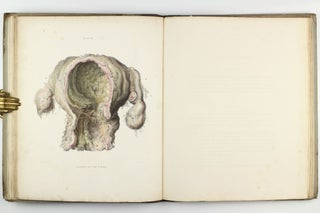 The Morbid Anatomy of the Human Uterus and its Appendages, with Illustrations of the Most Frequent and Important Organic Diseases To Which Those Viscera are Subject.