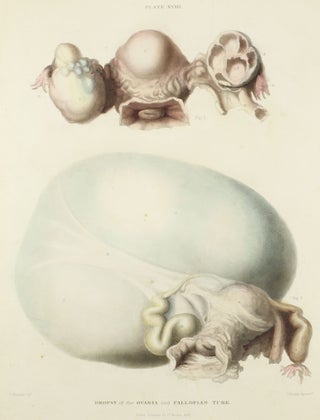 The Morbid Anatomy of the Human Uterus and its Appendages, with Illustrations of the Most Frequent and Important Organic Diseases To Which Those Viscera are Subject.
