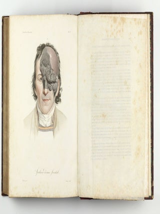 Monographie des dermatoses ou precis theorique et pratique des maladies de la peau. Seconde édition, revue, corrigée et augmentée de planches coloriées représentant environ trente espèces ou variétés de maladies.