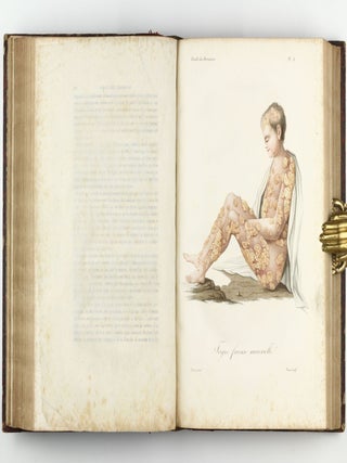 Monographie des dermatoses ou precis theorique et pratique des maladies de la peau. Seconde édition, revue, corrigée et augmentée de planches coloriées représentant environ trente espèces ou variétés de maladies.