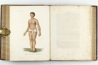 Monographie des dermatoses ou precis theorique et pratique des maladies de la peau. Seconde édition, revue, corrigée et augmentée de planches coloriées représentant environ trente espèces ou variétés de maladies.