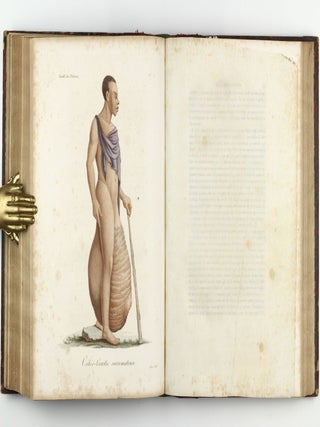 Monographie des dermatoses ou precis theorique et pratique des maladies de la peau. Seconde édition, revue, corrigée et augmentée de planches coloriées représentant environ trente espèces ou variétés de maladies.