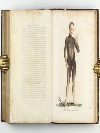 Monographie des dermatoses ou precis theorique et pratique des maladies de la peau. Seconde édition, revue, corrigée et augmentée de planches coloriées représentant environ trente espèces ou variétés de maladies.