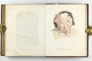 Monographie des dermatoses ou precis theorique et pratique des maladies de la peau. Seconde édition, revue, corrigée et augmentée de planches coloriées représentant environ trente espèces ou variétés de maladies.