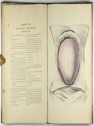 Myology, illustrated by plates. In four parts / A Supplement To Myology: Containing The Arteries, Veins, Nerves, And Lymphatics Of The Human Body, The Abdominal & Thoracic Viscera, The Ear And Eye, The Brain, And The Gravid Uterus, With The Foetal Circulation.