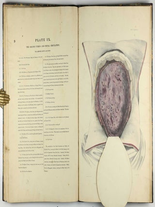 Myology, illustrated by plates. In four parts / A Supplement To Myology: Containing The Arteries, Veins, Nerves, And Lymphatics Of The Human Body, The Abdominal & Thoracic Viscera, The Ear And Eye, The Brain, And The Gravid Uterus, With The Foetal Circulation.