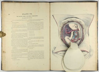 Myology, illustrated by plates. In four parts / A Supplement To Myology: Containing The Arteries, Veins, Nerves, And Lymphatics Of The Human Body, The Abdominal & Thoracic Viscera, The Ear And Eye, The Brain, And The Gravid Uterus, With The Foetal Circulation.