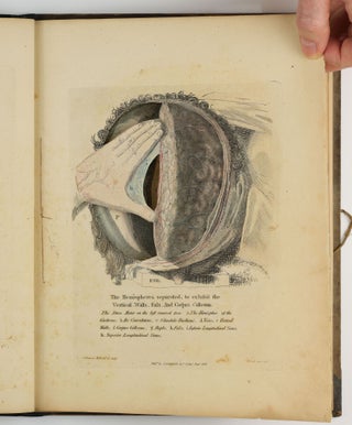 A Series of Plates of the Heart, Cranium, and Brain, in Imitation of Dissections.