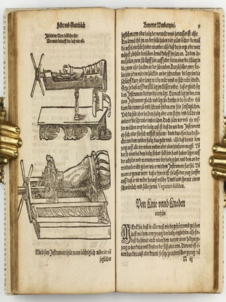 Feld und Stattbuch bewerter Wundtartznei. New widerumb ersehen zusampt dem Antidotari, Fürsorg und Vorrath der Chirurgei.