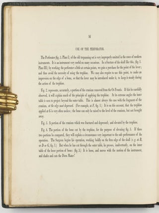 Illustrations of the Great Operations of Surgery, Trepan, Hernia, Amputation, Aneurism, and Lithotomy.