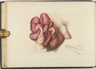 Illustrations of the Great Operations of Surgery, Trepan, Hernia, Amputation, Aneurism, and Lithotomy.